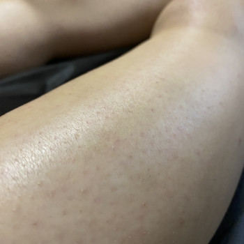 Ноги повністю
                    Мастер восковой депиляции  Белая Церковь