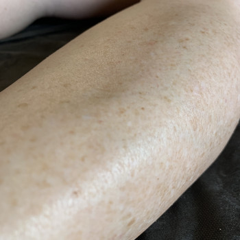 Ноги повністю
                    Мастер восковой депиляции  Белая Церковь