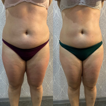 Альона Подільчик, Одеса Фото - 5