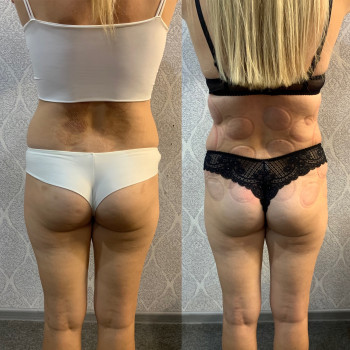 Альона Подільчик, Одеса Фото - 10