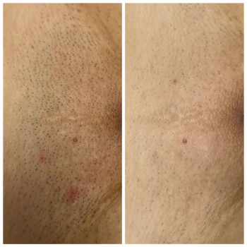 Татьяна Жездрис, Полтава Фото - 7