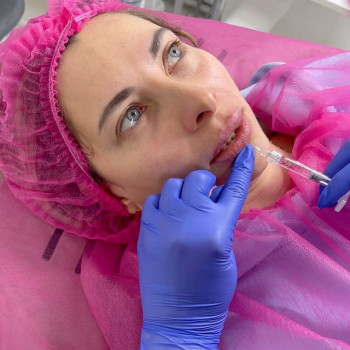 Vroda, Чернигов Фото - 6