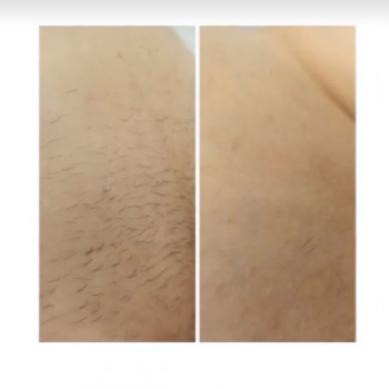 Laser Room, Черкассы Фото - 5