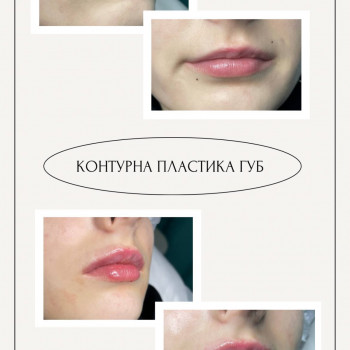 Dream Body, Черкассы Фото - 5