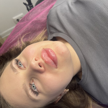 Збільшення губ
                    Мастер перманентного макияжа Екатерина Кременчуг