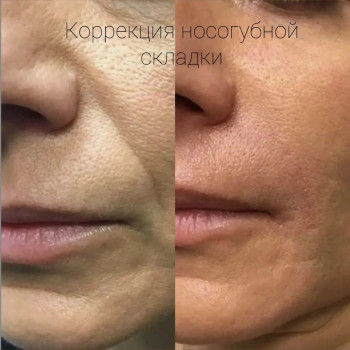 Lavanda, Покровськ Фото - 16