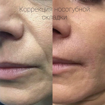 Lavanda, Покровськ Фото - 22