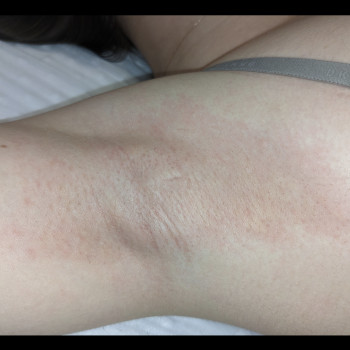 Катерина Мельник, Київ Фото - 6