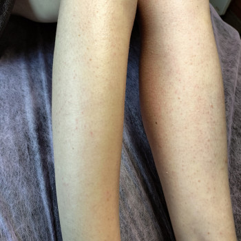 Ніжки до коліна. Результат після депіляції.