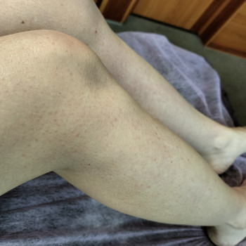 Ніжки до коліна, результат після депіляції.