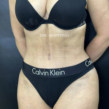 Абдель Эрритали, Харків Фото - 49