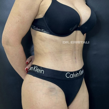 Абдель Эрритали, Харків Фото - 51