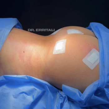 Абдель Эрритали, Київ Фото - 21