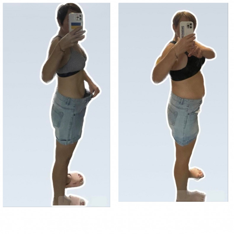  #велашейп
 #velashape
 #корекціяфігури
 #антицелюлітниймасаж, фото - Массажный салон Body Line