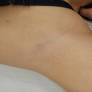 Светлана Бондарь, Полтава Фото - 12