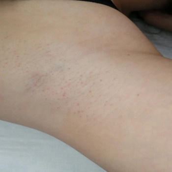 Светлана Бондарь, Полтава Фото - 11