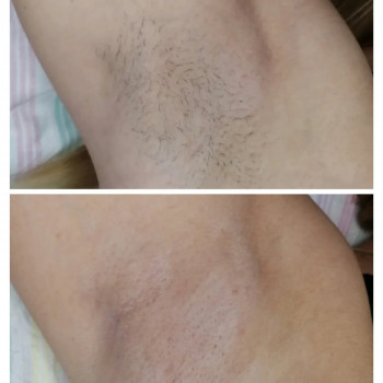 Светлана Бондарь, Полтава Фото - 10