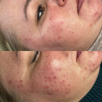 Алена Копейчик, Житомир Фото - 5