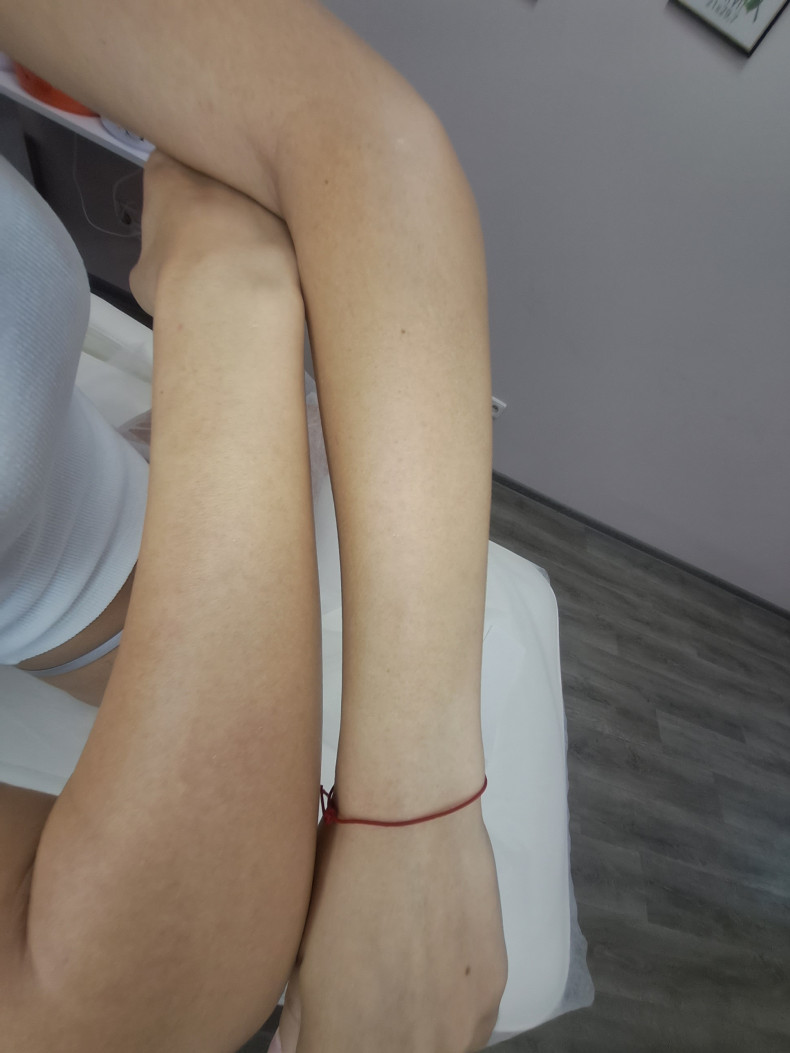 Депіляція рук вище ліктя
                    Мастер депиляции Дарья Киев