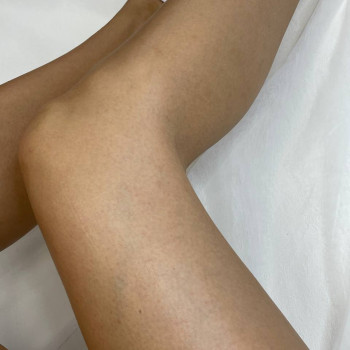 Дарья Сторчак, Киев Фото - 13