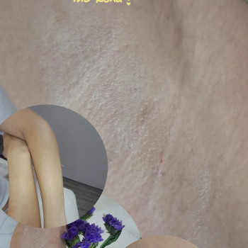 Дарья Сторчак, Киев Фото - 20