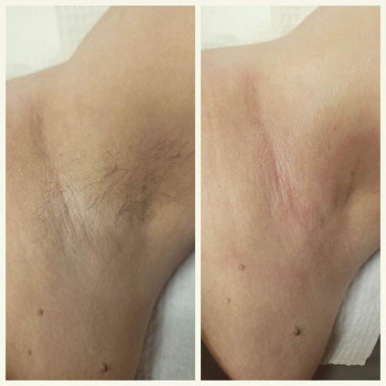 Дарья Сторчак, Киев Фото - 21