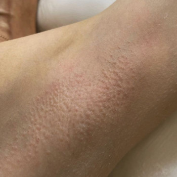 Дарья Сторчак, Киев Фото - 23