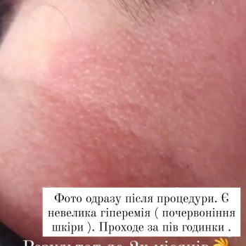 Дарья Сторчак, Киев Фото - 24