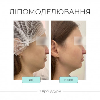 TK Laser, Вінниця Фото - 6