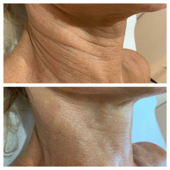 Галина Сітнік, Київ Фото - 2