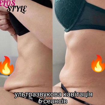 Elos Style, Житомир Фото - 8