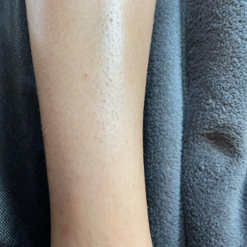 Фото из портфолио салона Black and White (студия депиляции, Житомир)