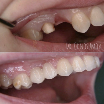 AVANTO, Одесса Фото - 5