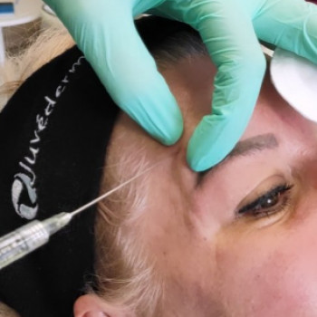 Beauty Apple, Сумы Фото - 5