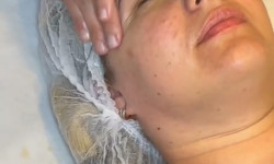 Лімфодренажний масаж обличчя Косметолог  Львов