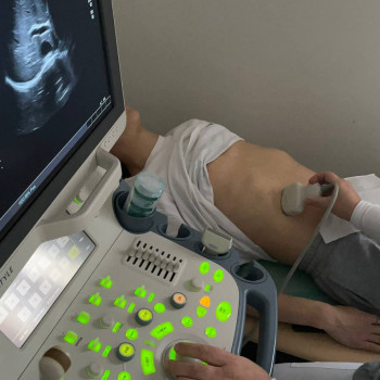 УЗД органів черевної порожнини