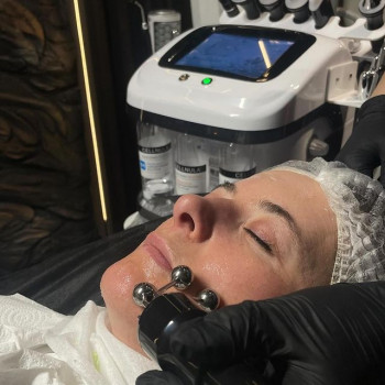 Laser by Max Tattoo, Хмельницкий Фото - 6