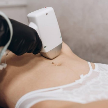 Premium Laser, Хмельницкий Фото - 5