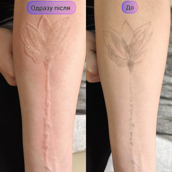 Ксенія Слива, Киев Фото - 5