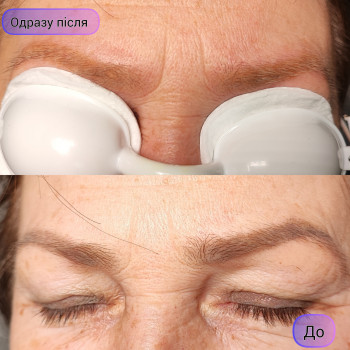 Ксенія Слива, Киев Фото - 24