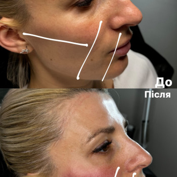 Вікторія Іваськевич, Ужгород Фото - 2