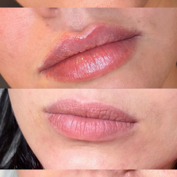 Вікторія Іваськевич, Ужгород Фото - 9