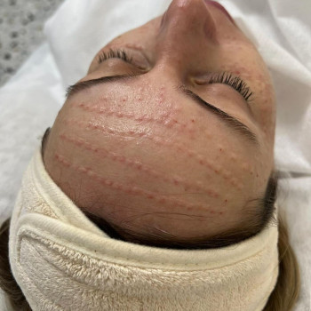 LaserMe, Черновцы Фото - 7