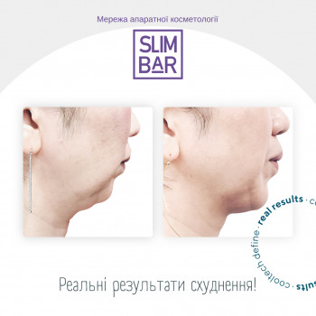 Slimbar, Київ Фото - 5