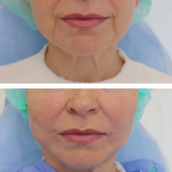 Allegrés, Чернівці Фото - 5