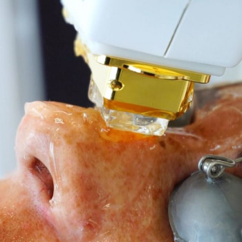 Allegrés, Чернівці Фото - 6