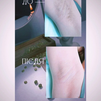 Руслана Клименко, Рівне Фото - 5