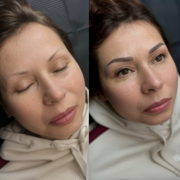 До та після процедури ПМ брів і очей