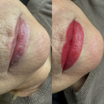 До та одразу після ПМ губ