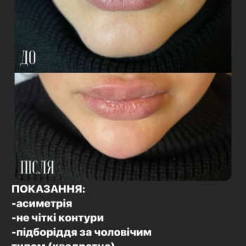 Підборіддя